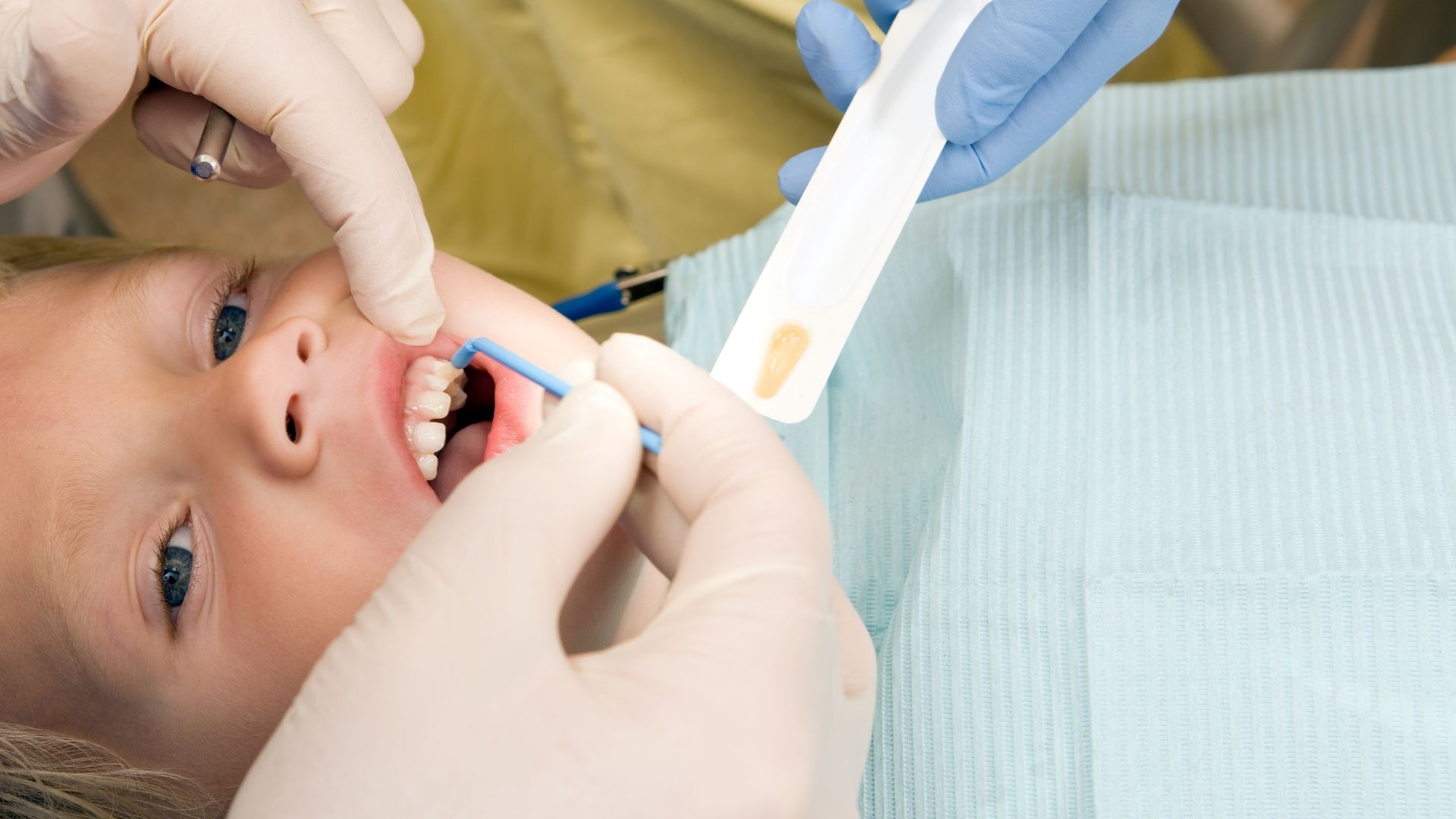 What to Expect at a Children’s Dentist Appointment